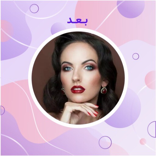 قبل و بعد ملیح