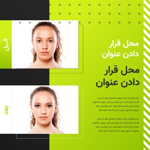 قبل و بعد اسپرت