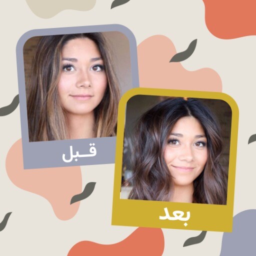 قبل و بعد مو