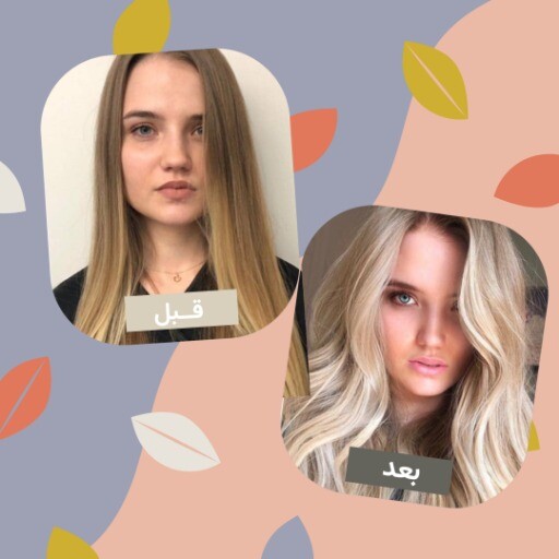 قبل و بعد مو