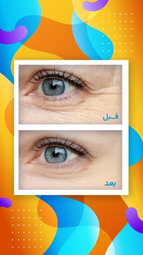 قبل و بعد رنگی