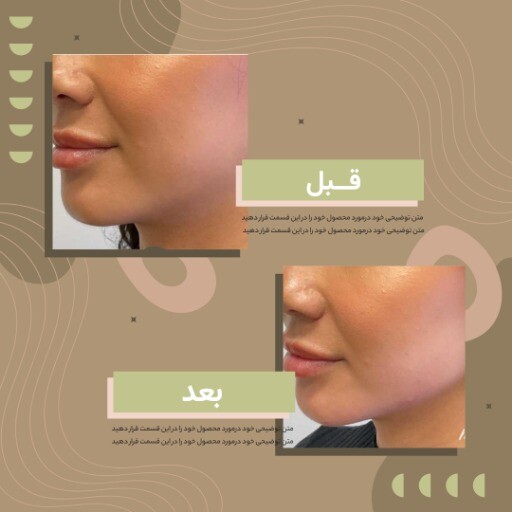 قبل و بعد جراحی