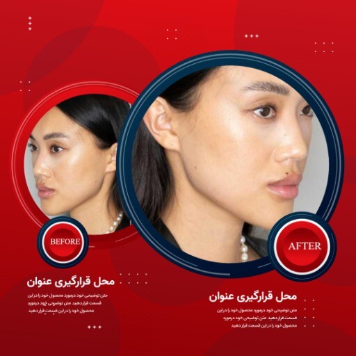 قبل و بعد قرمز زیبایی