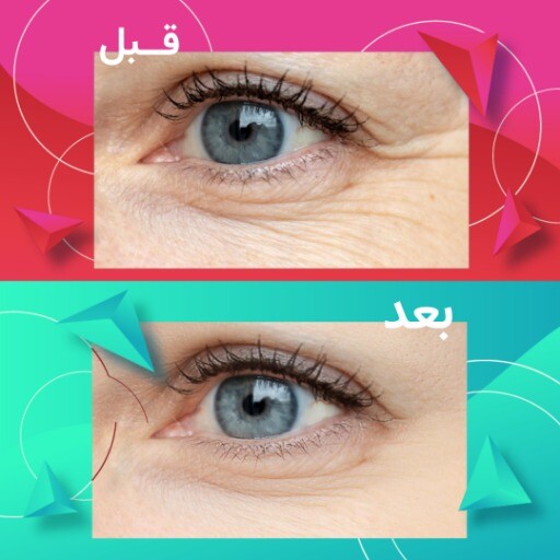 قبل و بعد رنگی