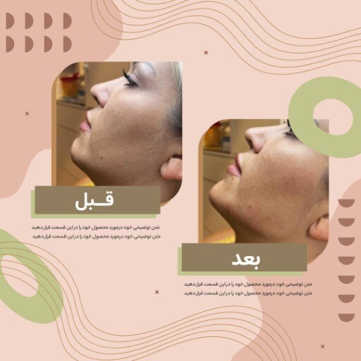 قبل و بعد جراحی