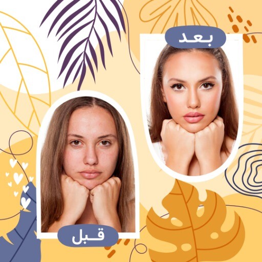 قبل و بعد