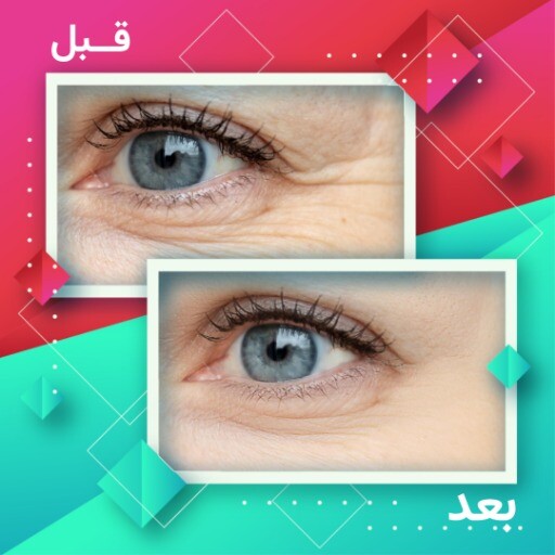 قبل و بعد رنگی