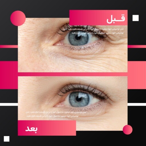 قبل و بعد آرایشی 
