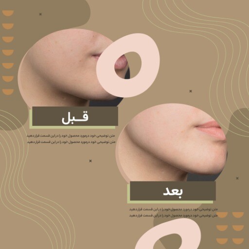 قبل و بعد جراحی