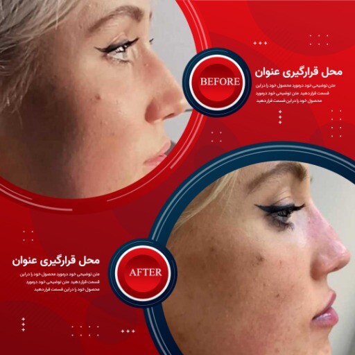 قبل و بعد قرمز زیبایی