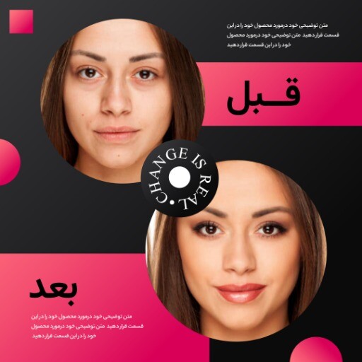 قبل و بعد آرایشی 