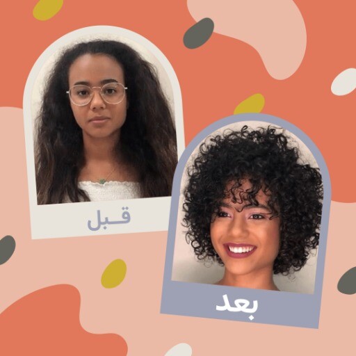 قبل و بعد مو