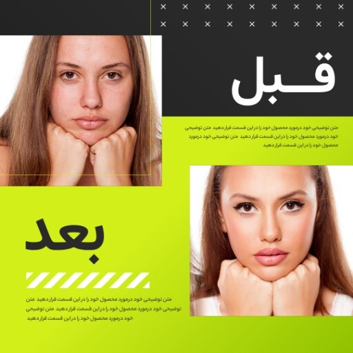 قبل و بعد اسپرت