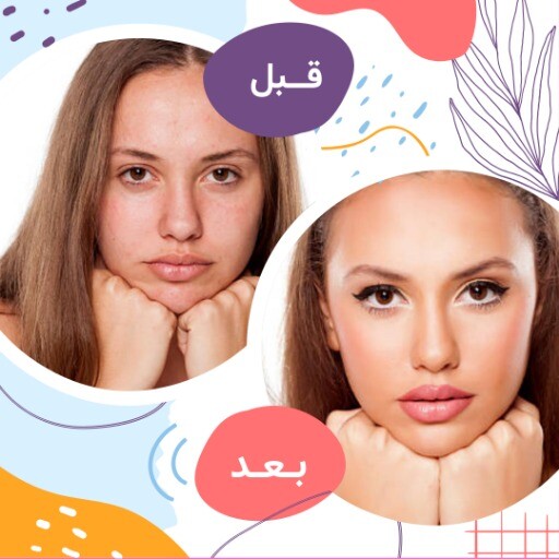 قبل وبعد