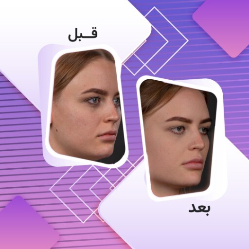 قبل و بعد زیبایی