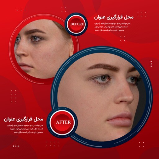 قبل و بعد قرمز زیبایی