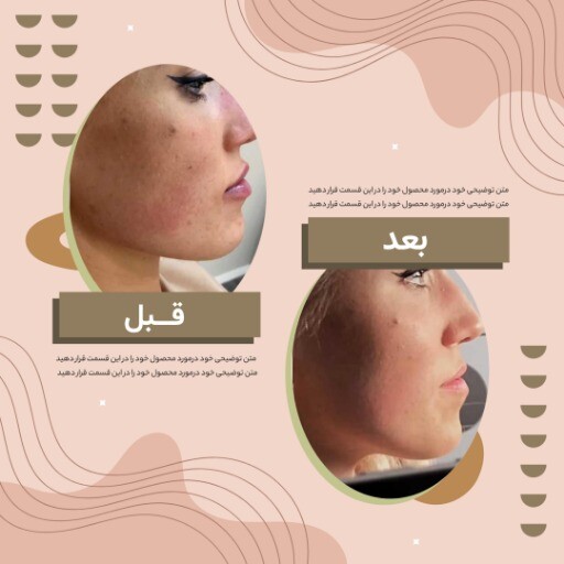 قبل و بعد جراحی