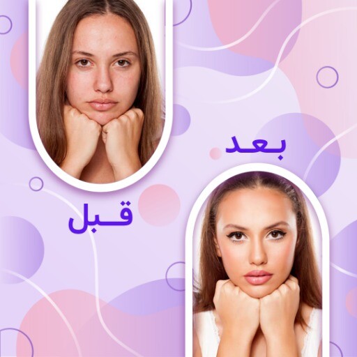 قبل و بعد ملیح