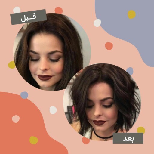 قبل و بعد مو