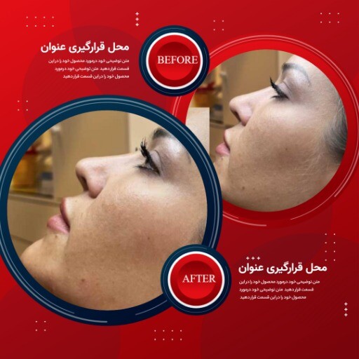 قبل و بعد قرمز زیبایی